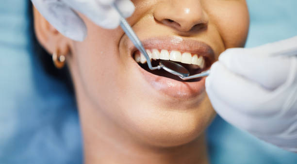 Best Broken or Cracked Tooth Emergency Dentist in Essex Village, CT