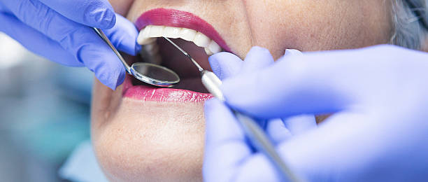 Best Emergency Dentist for Special Needs Patients in Essex Village, CT
